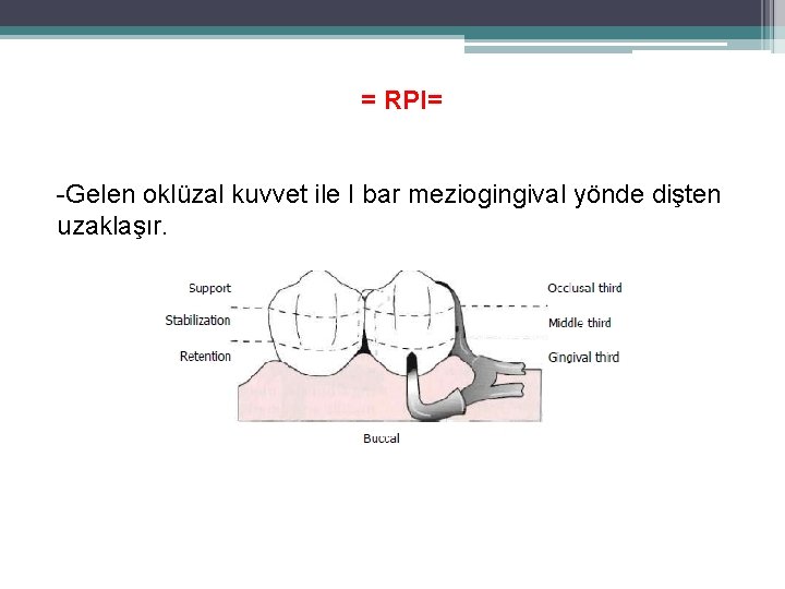 = RPI= -Gelen oklüzal kuvvet ile I bar meziogingival yönde dişten uzaklaşır. 