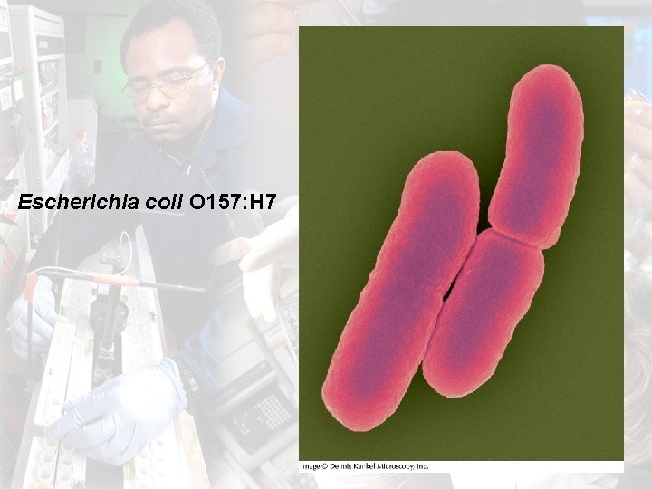 Escherichia coli O 157: H 7 