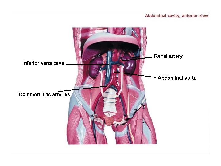 Renal artery Inferior vena cava Abdominal aorta Common iliac arteries 