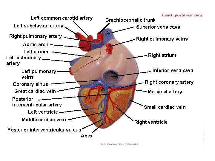Left common carotid artery Left subclavian artery Right pulmonary artery Brachiocephalic trunk Superior vena