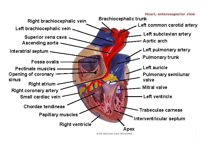 Right brachiocephalic vein Left brachiocephalic vein Brachiocephalic trunk Left common carotid artery Left subclavian