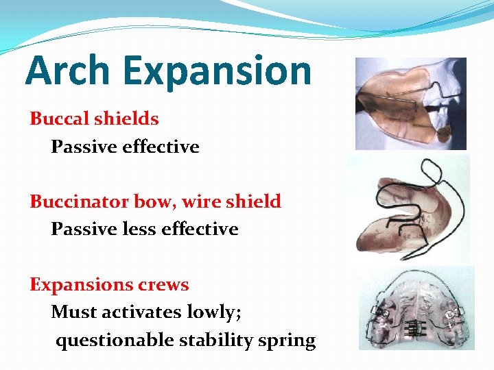 Arch Expansion Buccal shields Passive effective Buccinator bow, wire shield Passive less effective Expansions