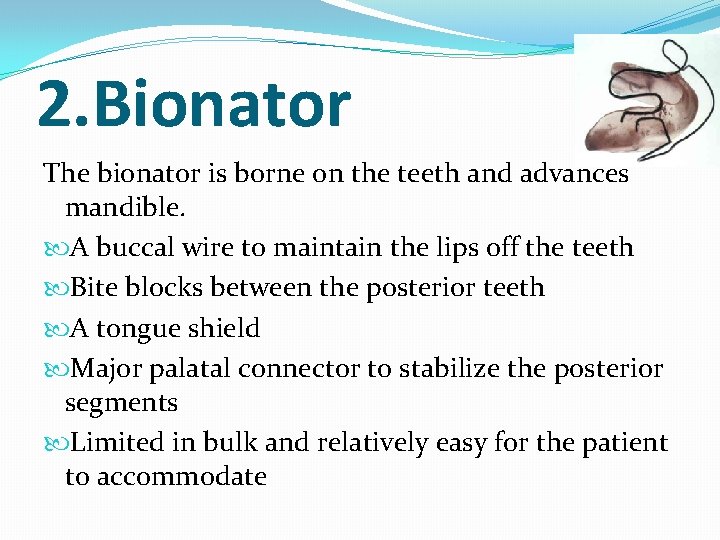 2. Bionator The bionator is borne on the teeth and advances mandible. A buccal
