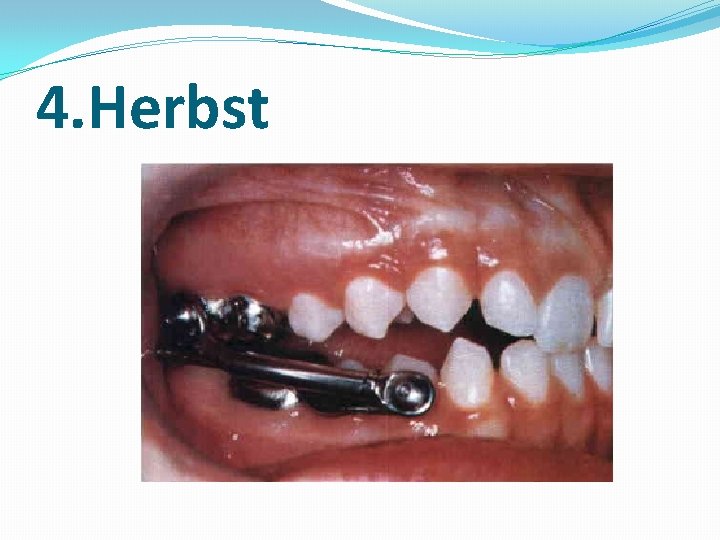 4. Herbst 