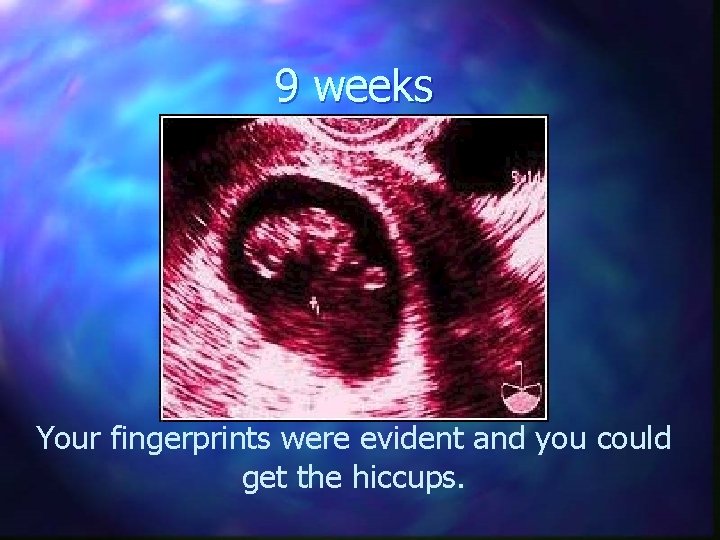 9 weeks Your fingerprints were evident and you could get the hiccups. 