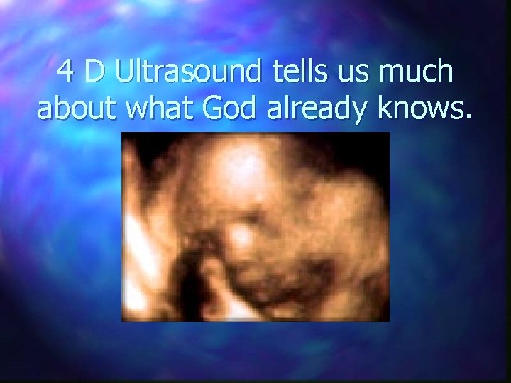 4 D Ultrasound tells us much about what God already knows. 