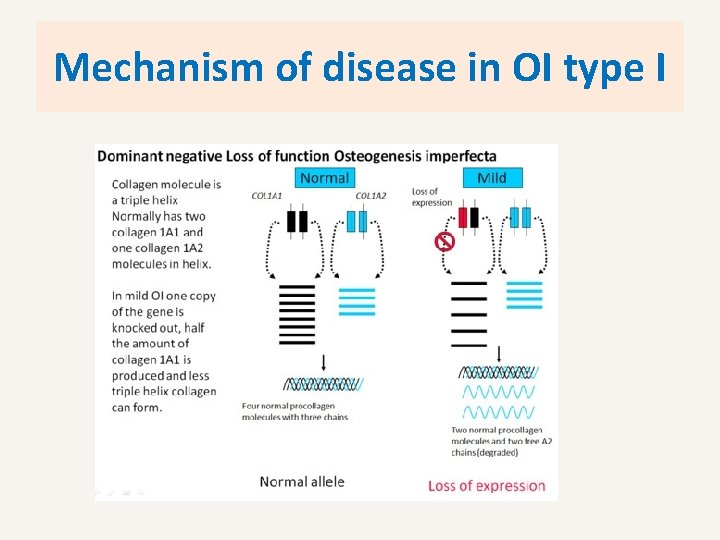 Mechanism of disease in OI type I 