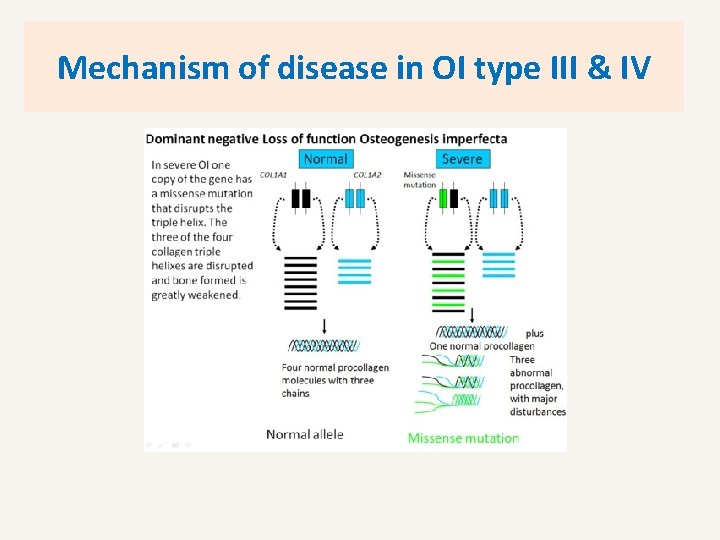 Mechanism of disease in OI type III & IV 