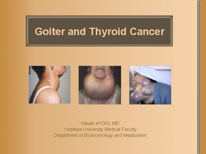 Goiter and Thyroid Cancer Hasan AYDIN, MD Yeditepe University Medical Faculty Department of Endocrinology