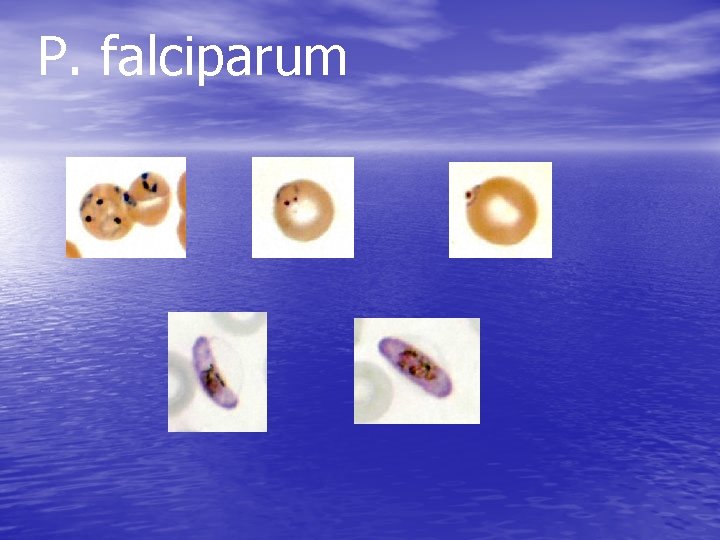 P. falciparum 