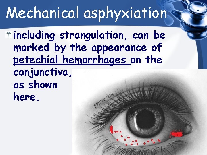 Mechanical asphyxiation including strangulation, can be marked by the appearance of petechial hemorrhages on