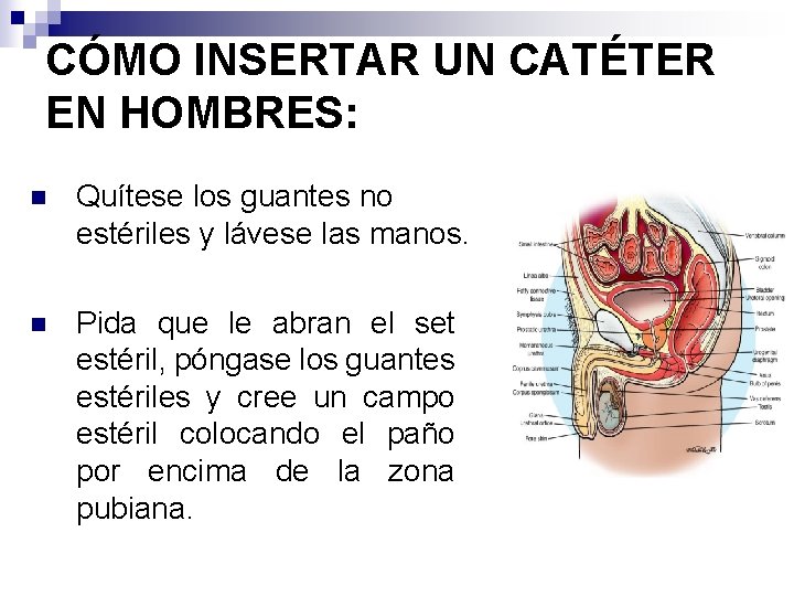CÓMO INSERTAR UN CATÉTER EN HOMBRES: n Quítese los guantes no estériles y lávese