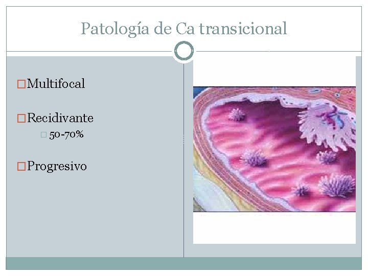 Patología de Ca transicional �Multifocal �Recidivante � 50 -70% �Progresivo 