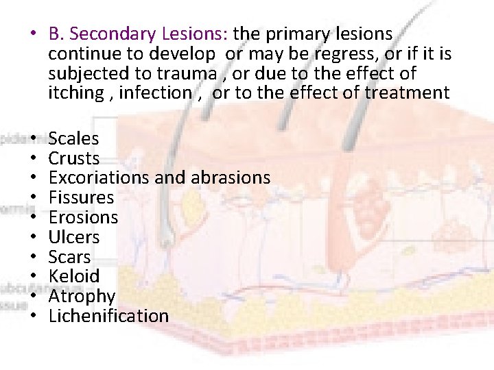  • B. Secondary Lesions: the primary lesions continue to develop or may be