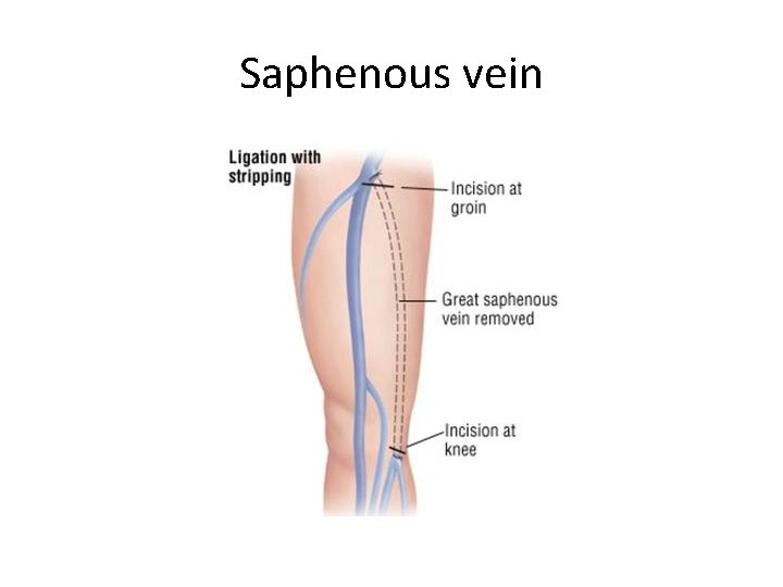 Saphenous vein 