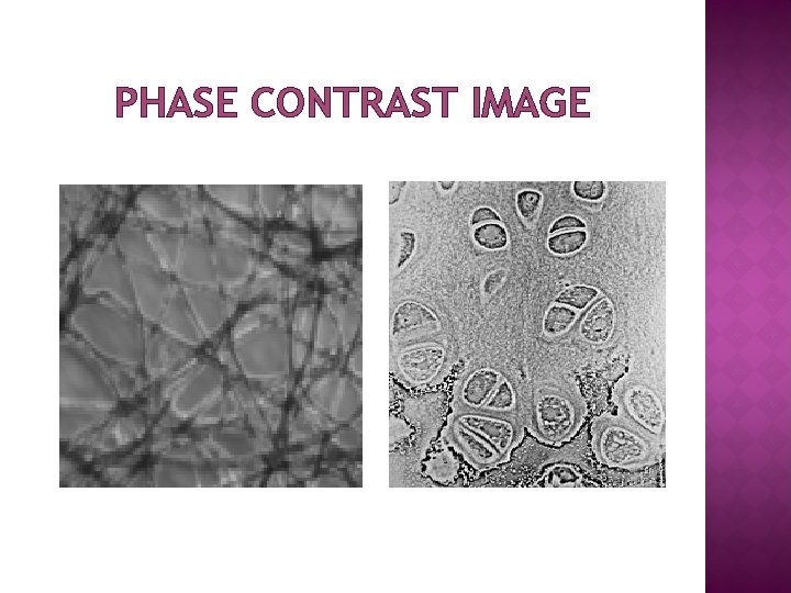 PHASE CONTRAST IMAGE 