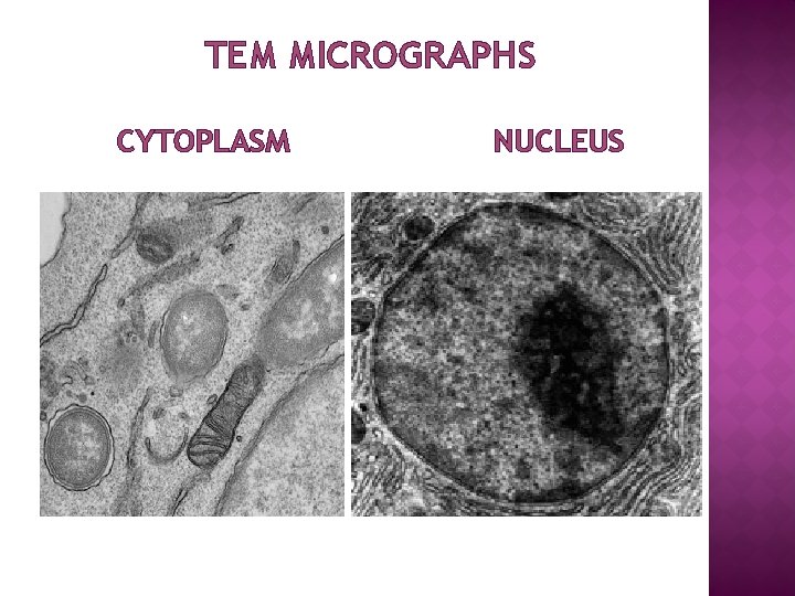 TEM MICROGRAPHS CYTOPLASM NUCLEUS 