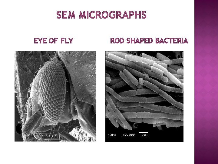 SEM MICROGRAPHS EYE OF FLY ROD SHAPED BACTERIA 