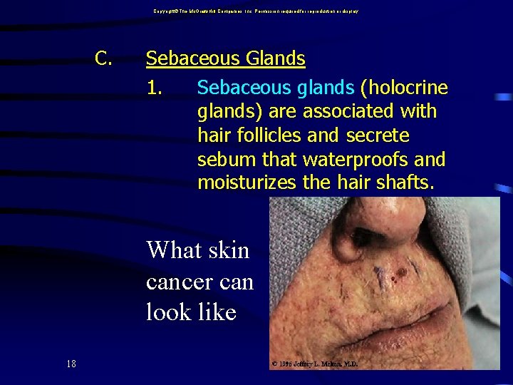 Copyright The Mc. Graw-Hill Companies, Inc. Permission required for reproduction or display. C. Sebaceous