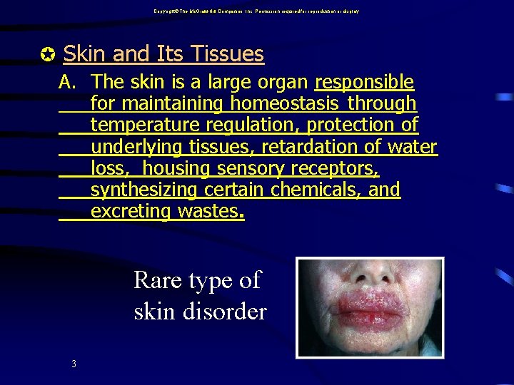 Copyright The Mc. Graw-Hill Companies, Inc. Permission required for reproduction or display. Skin and