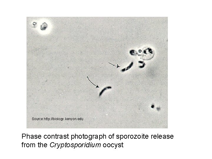 Source: http: //biology. kenyon. edu Phase contrast photograph of sporozoite release from the Cryptosporidium