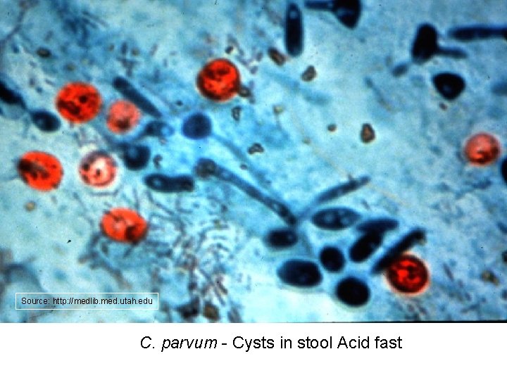 Source: http: //medlib. med. utah. edu C. parvum - Cysts in stool Acid fast