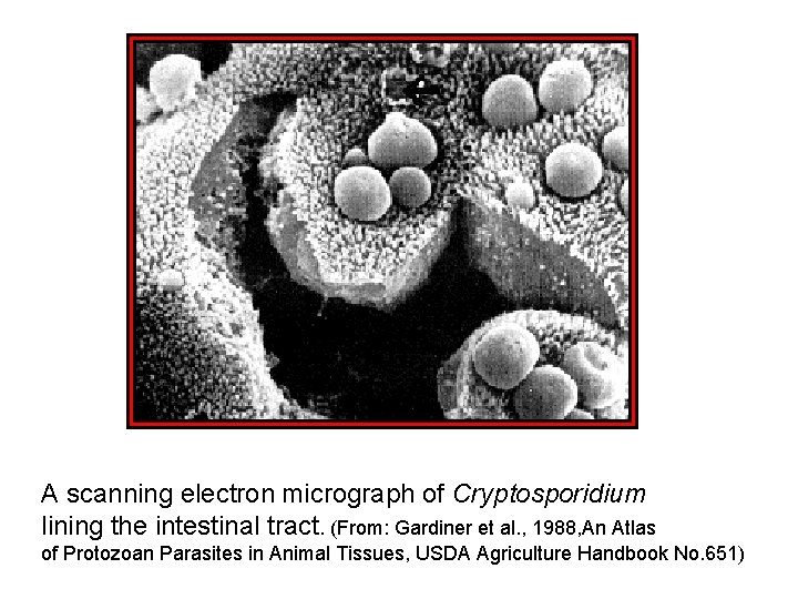 A scanning electron micrograph of Cryptosporidium lining the intestinal tract. (From: Gardiner et al.