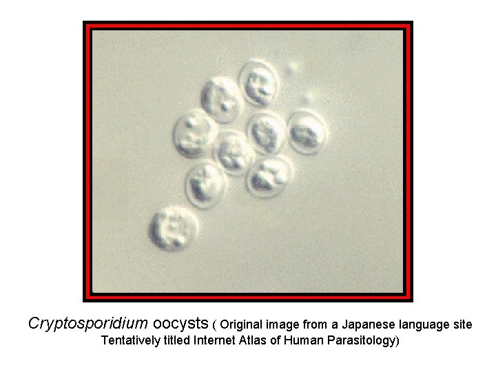 Cryptosporidium oocysts ( Original image from a Japanese language site Tentatively titled Internet Atlas