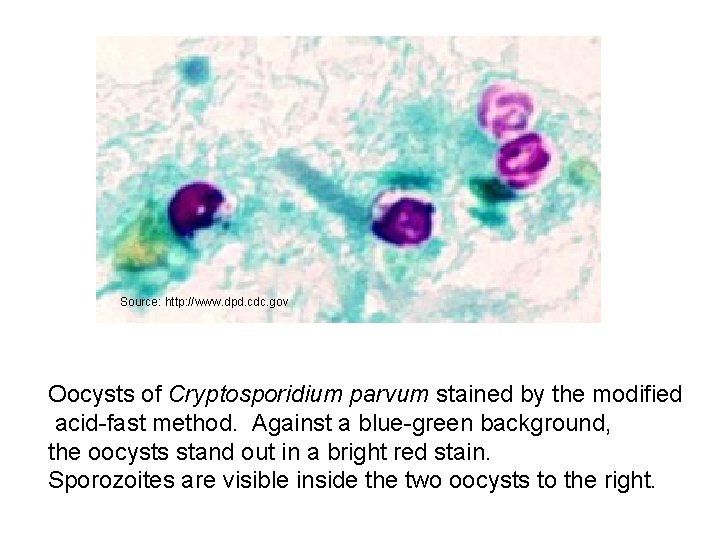 Source: http: //www. dpd. cdc. gov Oocysts of Cryptosporidium parvum stained by the modified