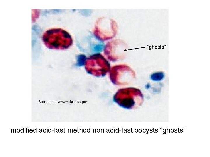 “ghosts” Source: http: //www. dpd. cdc. gov modified acid-fast method non acid-fast oocysts “ghosts”