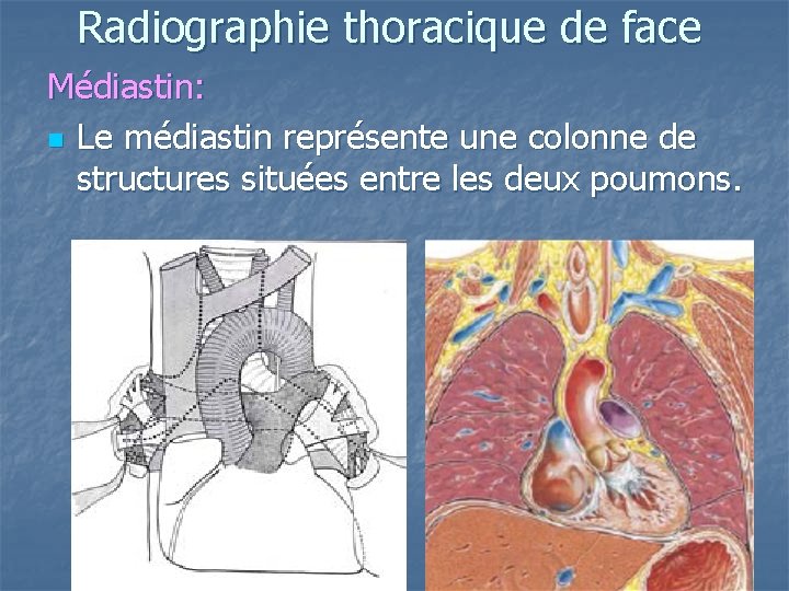Radiographie thoracique de face Médiastin: n Le médiastin représente une colonne de structures situées Radiographie thoracique de face Médiastin: n Le médiastin représente une colonne de structures situées