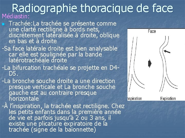 Radiographie thoracique de face Médiastin: n Trachée: La Trachée: trachée se présente comme une Radiographie thoracique de face Médiastin: n Trachée: La Trachée: trachée se présente comme une