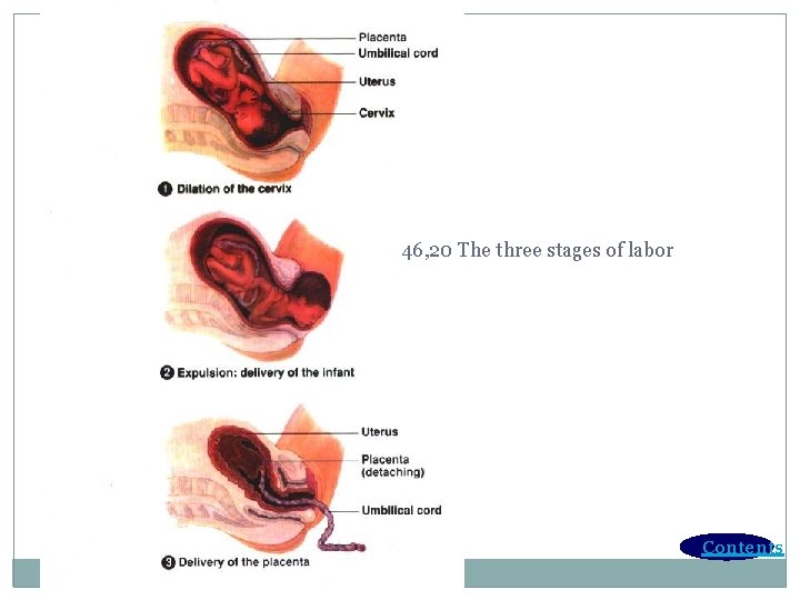 46, 20 The three stages of labor Contents 