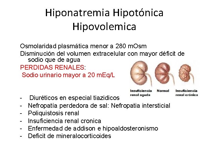 Hiponatremia Hipotónica Hipovolemica Osmolaridad plasmática menor a 280 m. Osm Disminución del volumen extracelular
