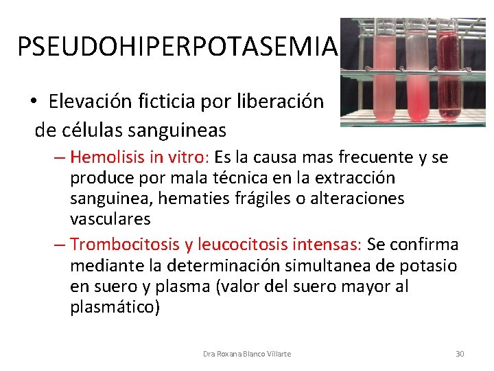 PSEUDOHIPERPOTASEMIA • Elevación ficticia por liberación de células sanguineas – Hemolisis in vitro: Es