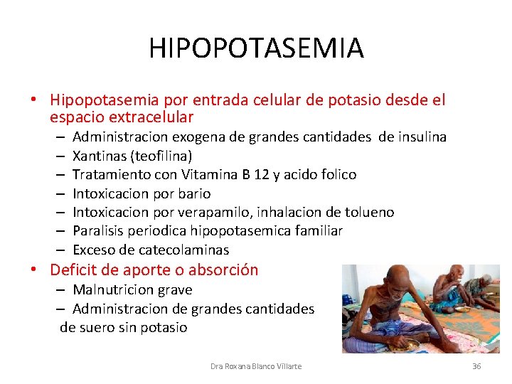 HIPOPOTASEMIA • Hipopotasemia por entrada celular de potasio desde el espacio extracelular – –