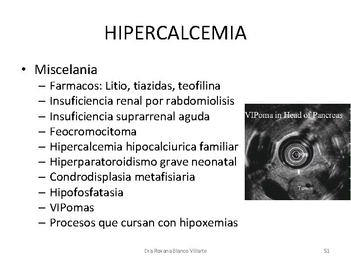 HIPERCALCEMIA • Miscelania – Farmacos: Litio, tiazidas, teofilina – Insuficiencia renal por rabdomiolisis –