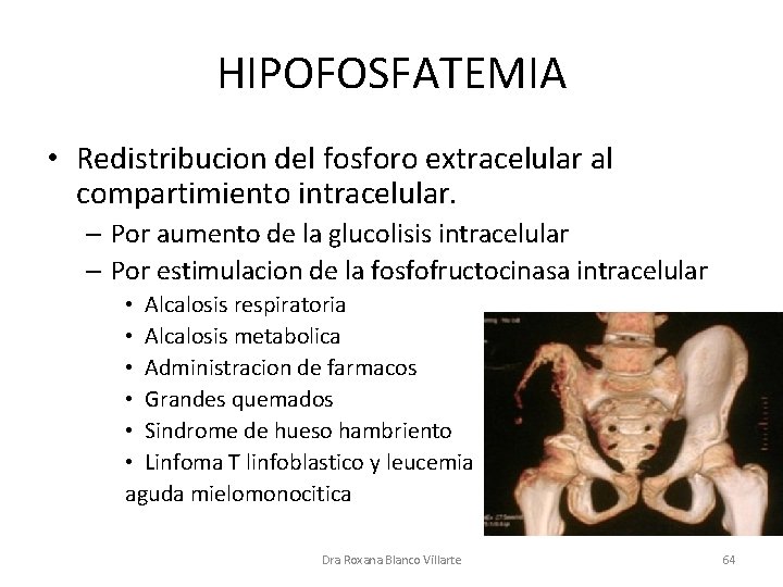 HIPOFOSFATEMIA • Redistribucion del fosforo extracelular al compartimiento intracelular. – Por aumento de la