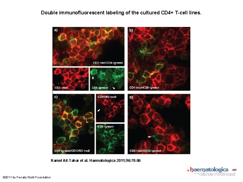 Double immunofluorescent labeling of the cultured CD 4+ T-cell lines. Kamel Ait-Tahar et al.