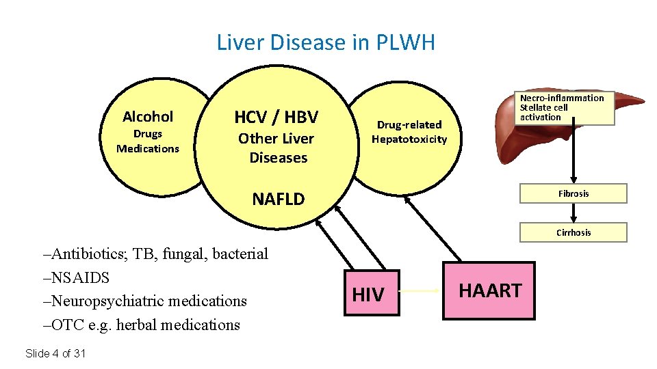 Liver Disease in PLWH Alcohol Drugs Medications HCV / HBV Other Liver Diseases Drug-related