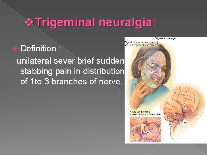 v. Trigeminal neuralgia: Definition : unilateral sever brief sudden stabbing pain in distribution of