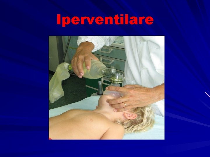 Iperventilare 