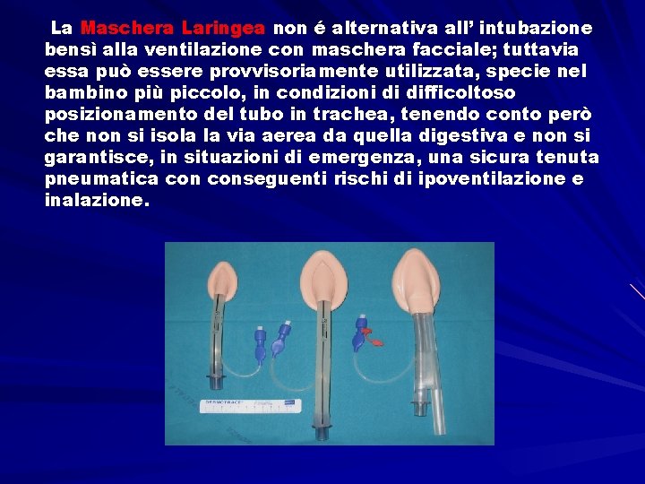 La Maschera Laringea non é alternativa all’ intubazione bensì alla ventilazione con maschera facciale;