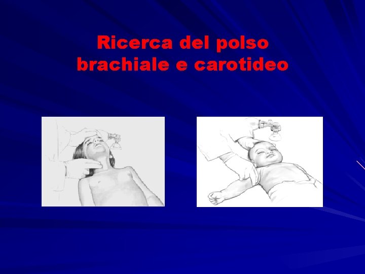 Ricerca del polso brachiale e carotideo 