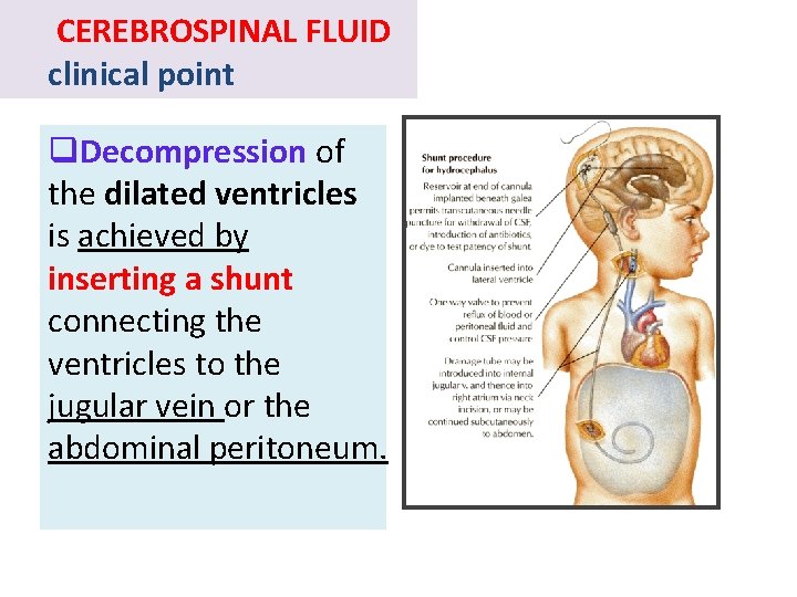 CEREBROSPINAL FLUID clinical point q. Decompression of the dilated ventricles is achieved by inserting CEREBROSPINAL FLUID clinical point q. Decompression of the dilated ventricles is achieved by inserting