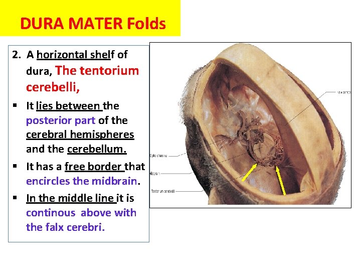 DURA MATER Folds 2. A horizontal shelf of dura, The tentorium cerebelli, § It DURA MATER Folds 2. A horizontal shelf of dura, The tentorium cerebelli, § It