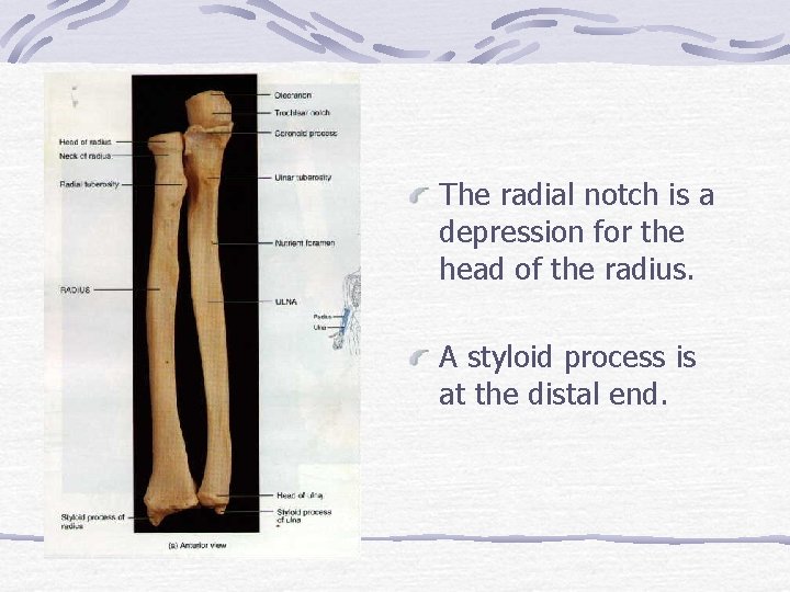 The radial notch is a depression for the head of the radius. A styloid