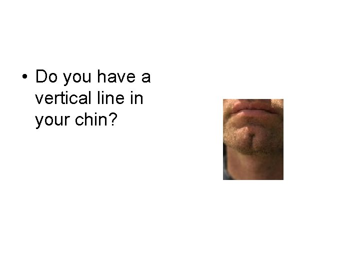  • Do you have a vertical line in your chin? 