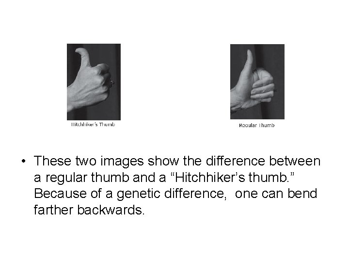  • These two images show the difference between a regular thumb and a