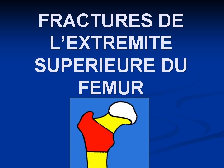 FRACTURES DE L’EXTREMITE SUPERIEURE DU FEMUR 